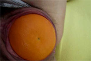 Sinaasappel in de kut