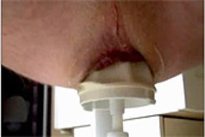 Extreme anus penetratie